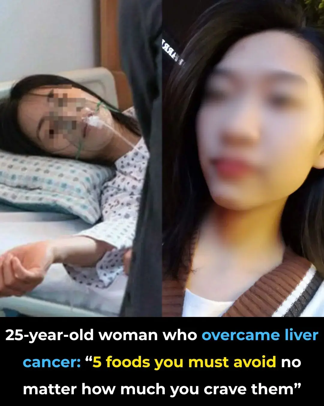 ผู้รอดชีวิตจากโรคมะเร็งตับวัย 25 ปี แบ่งปัน: "อาหาร 5 อย่างที่คุณต้องหลีกเลี่ยง ไม่ว่าคุณจะอย